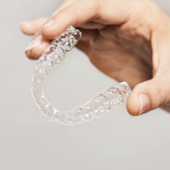 Alinhador Transparente preço - Instituto Caiado - Odontologia