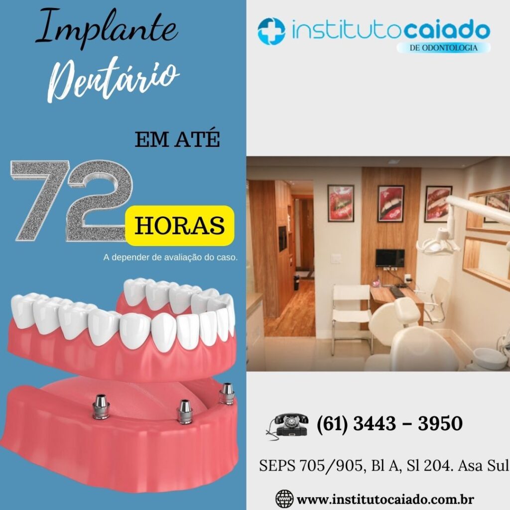 Quanto custa um implante dentário em Brasília? - Instituto Caiado ...