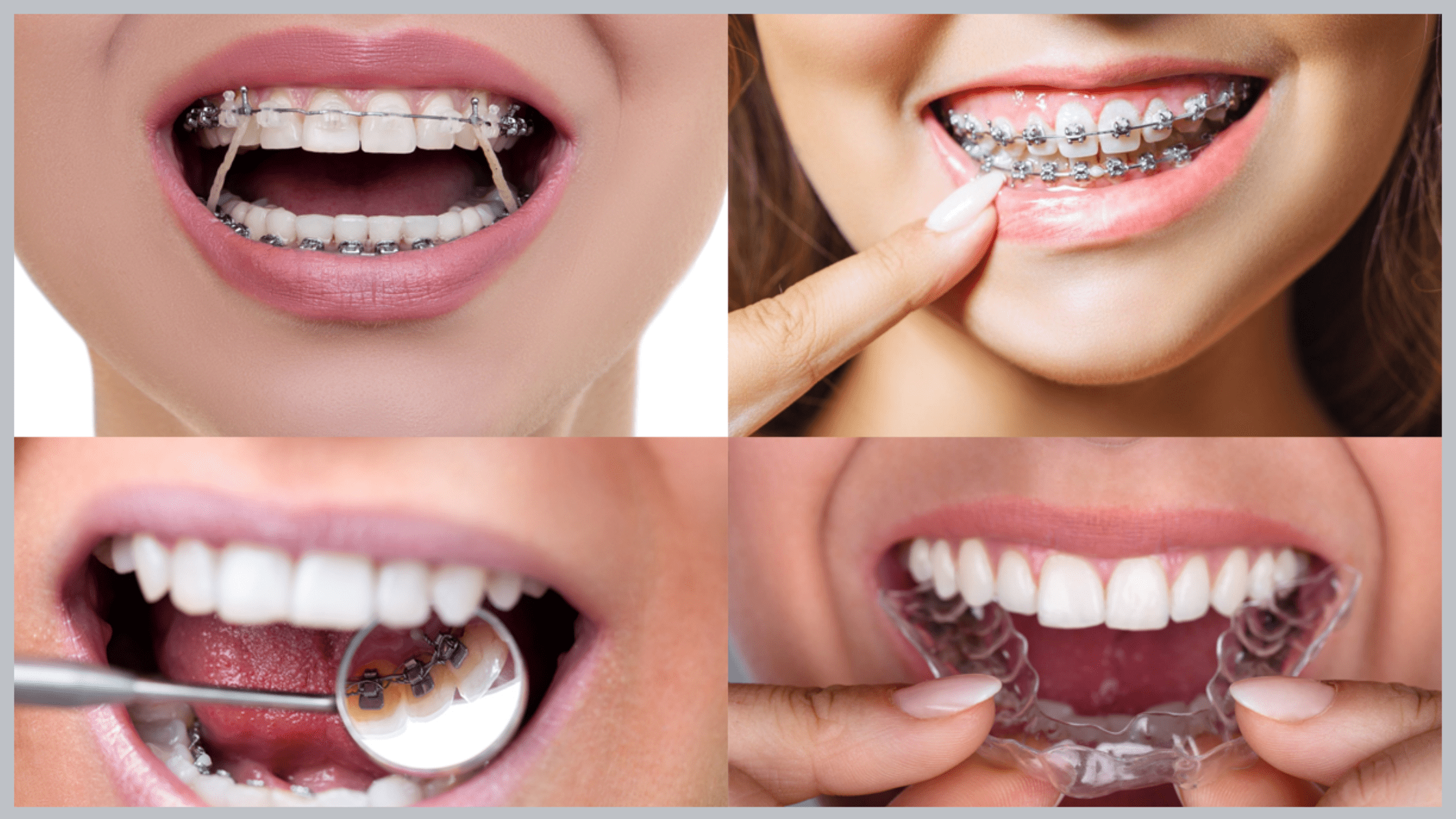 OrthoDontic - E aí, esse quiz está muito fácil, ein? Opção