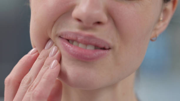 Estomatite Desvendando Sintomas e Tratamentos